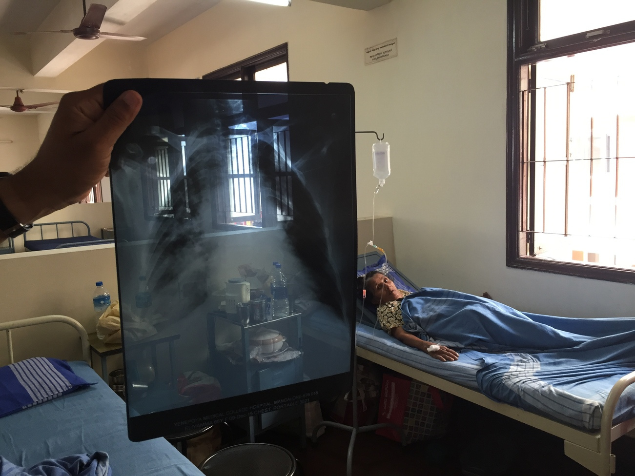 My take on the 2016 Global TB Report by WHO