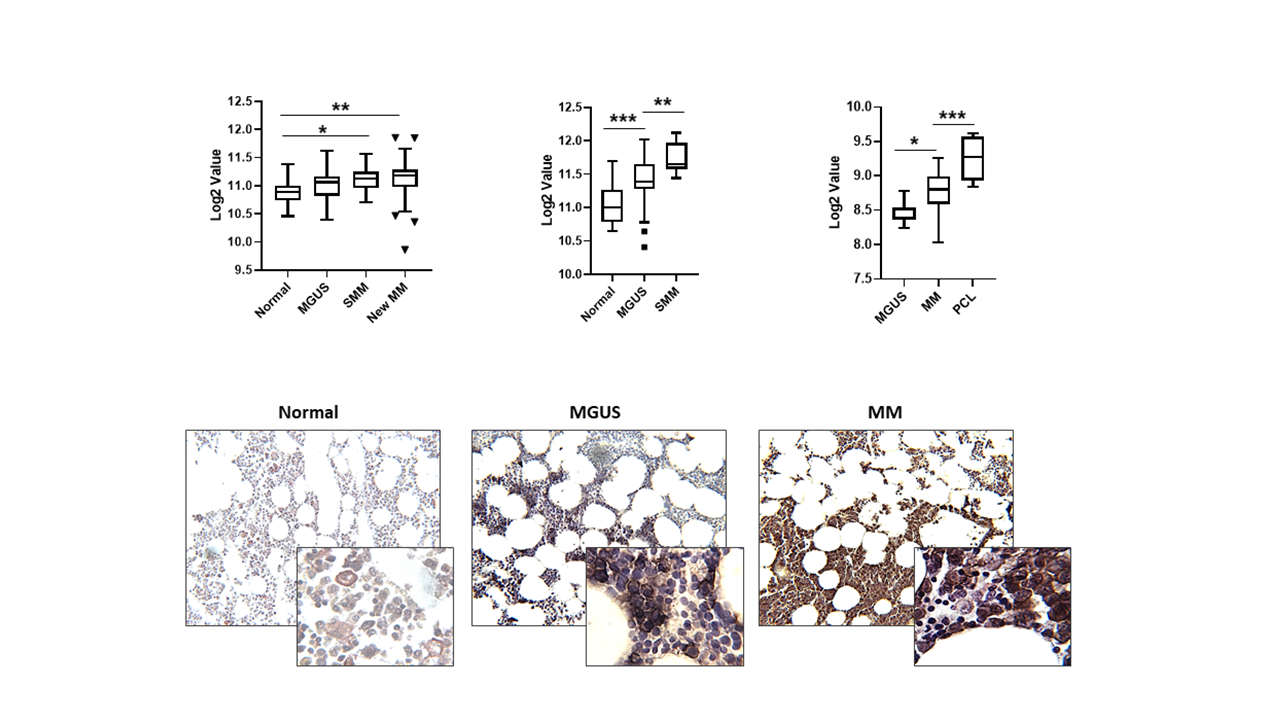 The E3 ligase HUWE1 inhibition as a therapeutic strategy to target MYC in Multiple Myeloma