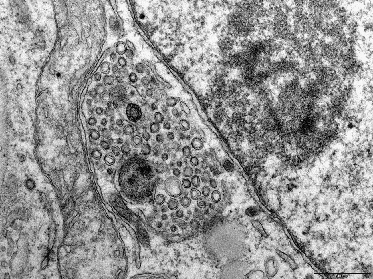 Dose matters: Understanding adaptation of Hepatitis C virus to cell culture