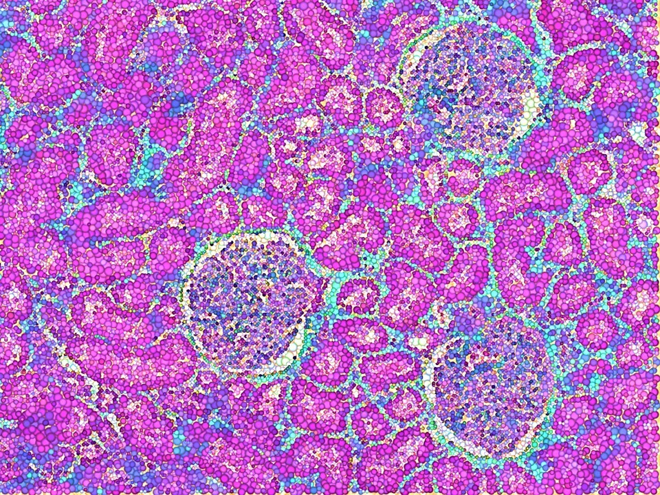 Precision Health on a kidney-on-a-chip: developing state-of-the-art microphysiology platforms
