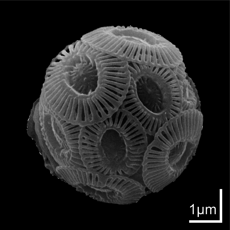 Fewer blooms of calcifying phytoplankton in a future ocean?