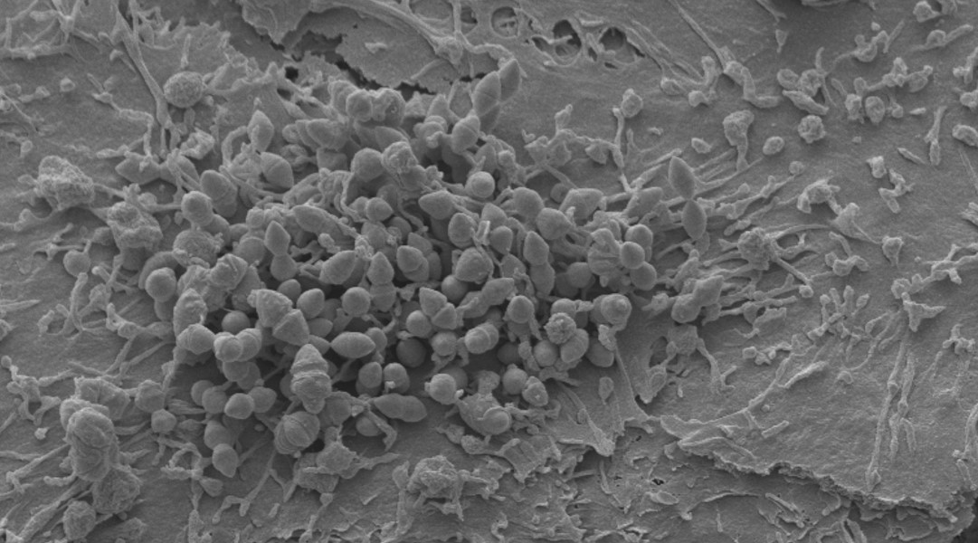 After the Paper: Pneumococcal-Epithelial Interactions