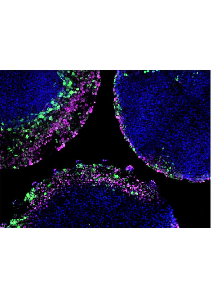 Organoid development: Breaking the symmetry with localized signalling sources