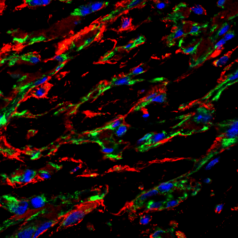 Developmental cues provided by stem cell-derived epicardial cells move forward cardiomyocyte-based heart repair. 