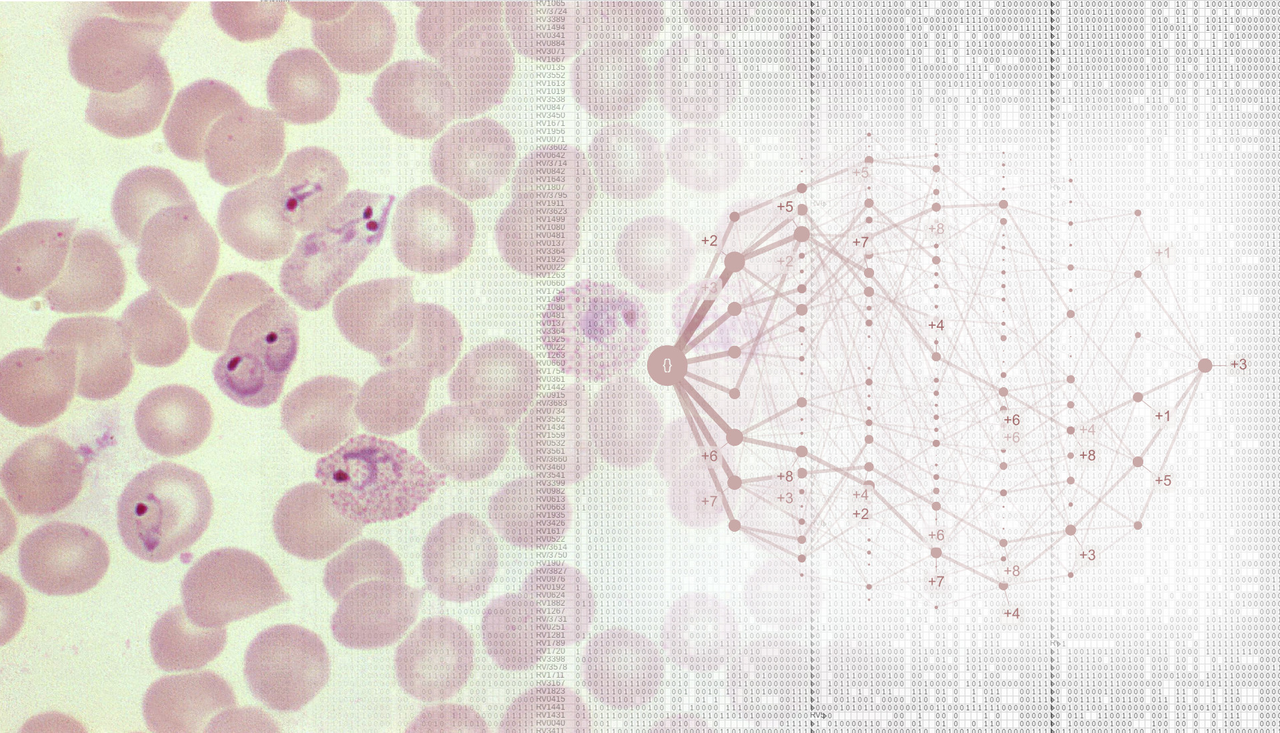 Phenotypes and progression pathways in severe malaria