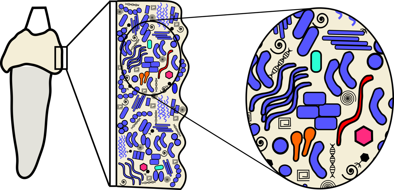 Ancient dental calculus offers new perspectives in evolutionary medicine 