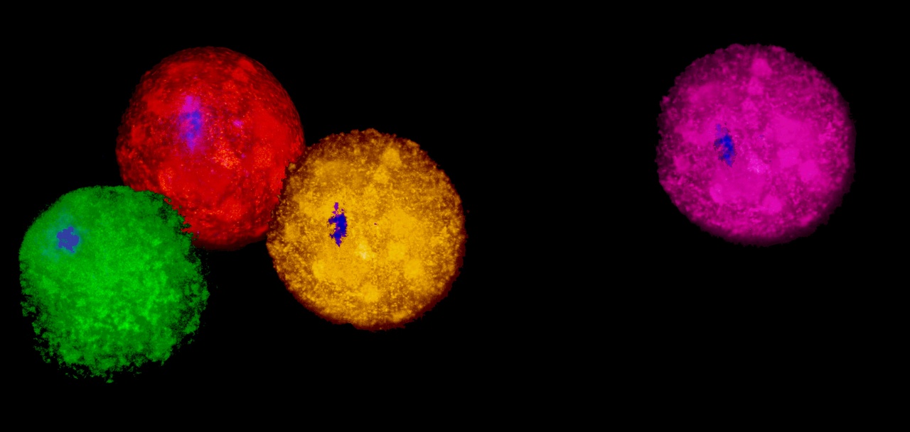 De novo mutations in mitochondrial DNA of iPSCs produce immunogenic neoepitopes in mice and humans
