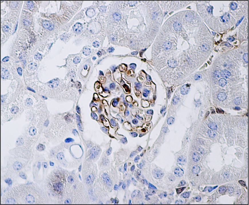 Discovery of genetic risk variants for Diabetic Kidney Disease in susceptible mice.