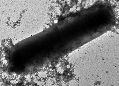 Less sugar will help. 