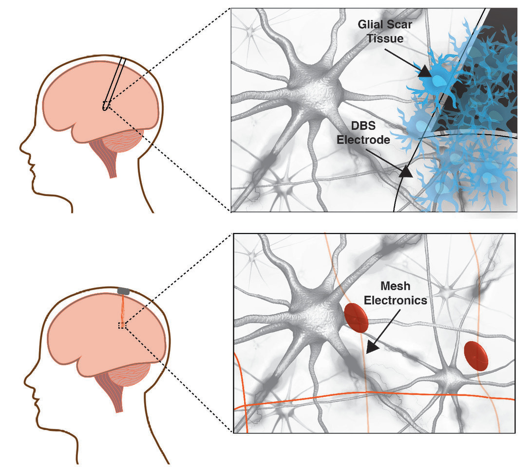 Precision electronic medicine in the brain