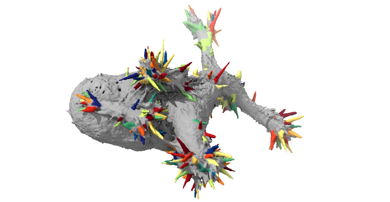 Automatically detecting subcellular morphologies with u-shape3D