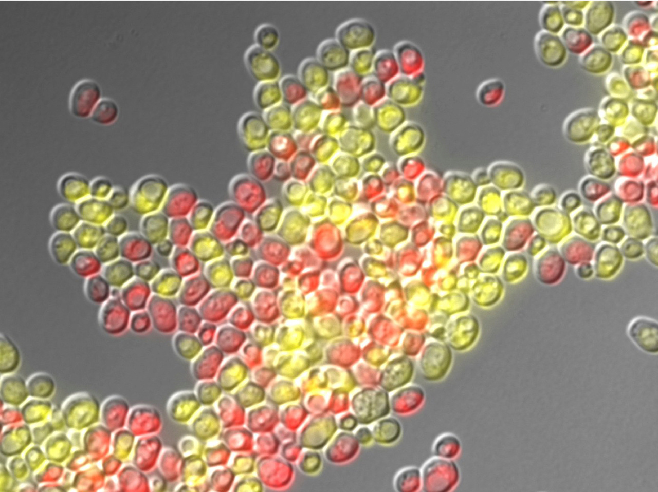 Dining with microbes: brewer’s yeast and the canine take on steakhouse syndrome