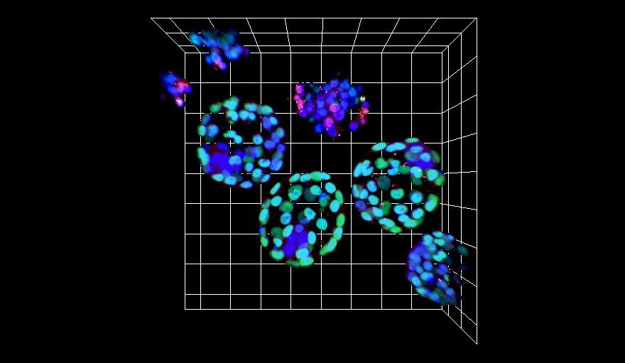 Zika and the earliest stages of development