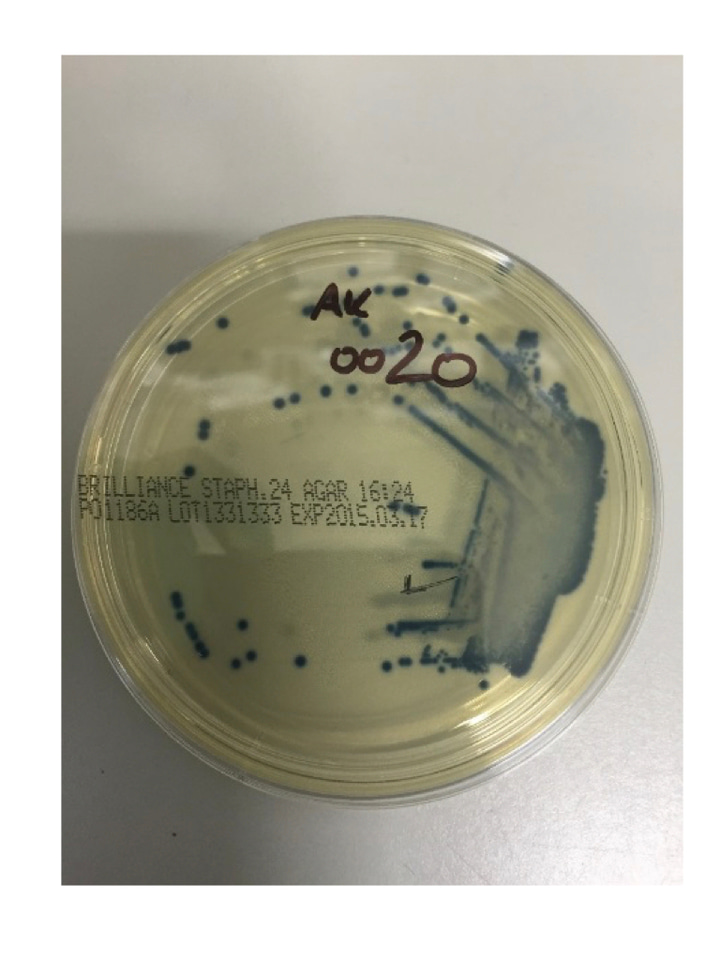 What does the nasal microbiome tell us about granulomatosis with polyangiitis?