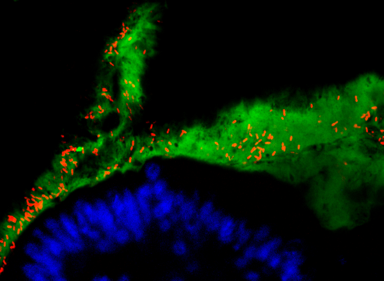 Ruminococcus gnavus: a peculiar dining guest