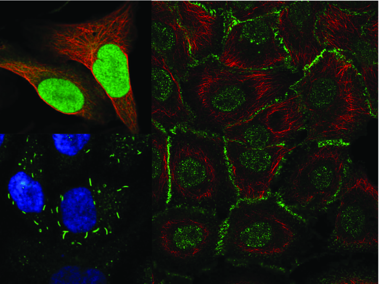 Behind the HPA Image Classification Competition