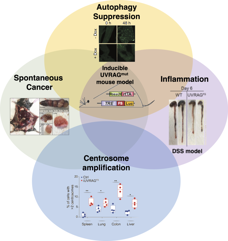 Reduced autophagy capacity lowers the bar for inflammation and cancer in mouse model