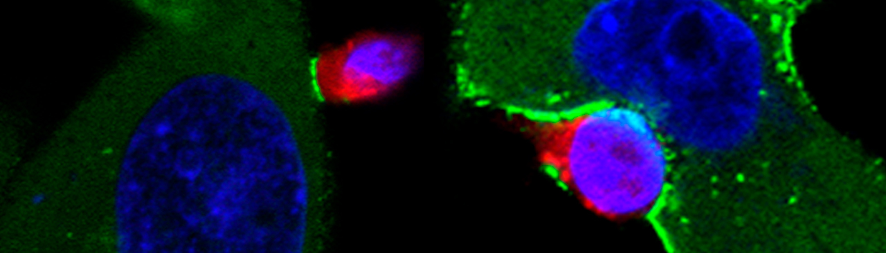 HIV entry into the wrong T cell: not a “dead-end” but a “highway” for viral spread