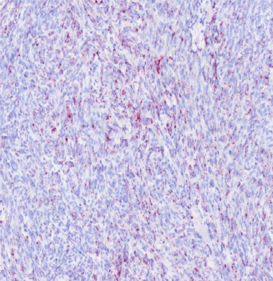 SK1 a checkpoint lipid kinase for immunotherapy