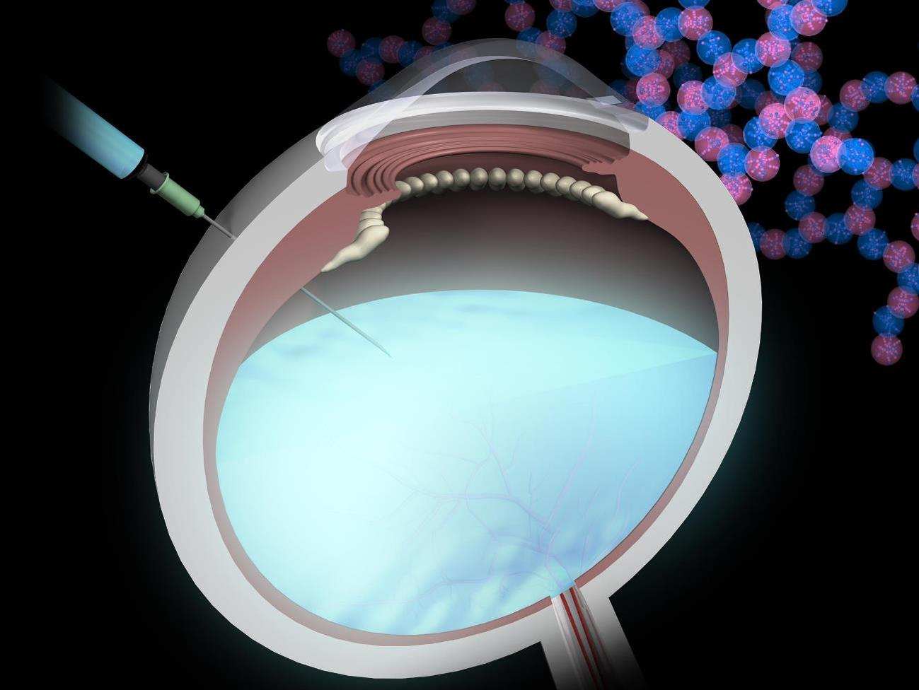 A fast-forming non-swelling hydrogel