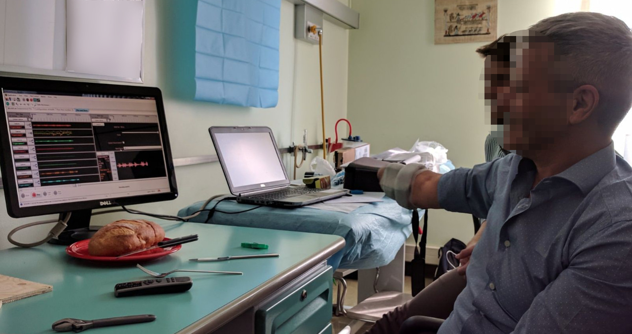 The MeganePro data: a resource to improve hand prostheses control, its embodiment, and to understand the effect of hand amputation on cognition