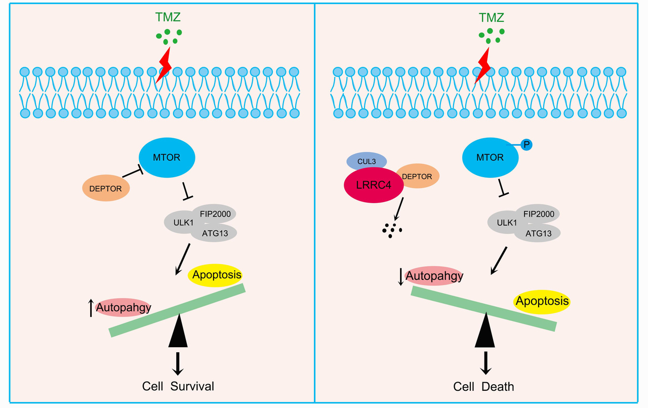 Leucine-rich repeat containing 4 act as an autophagy inhibitor that restores sensitivity of glioblastoma to Temozolomide