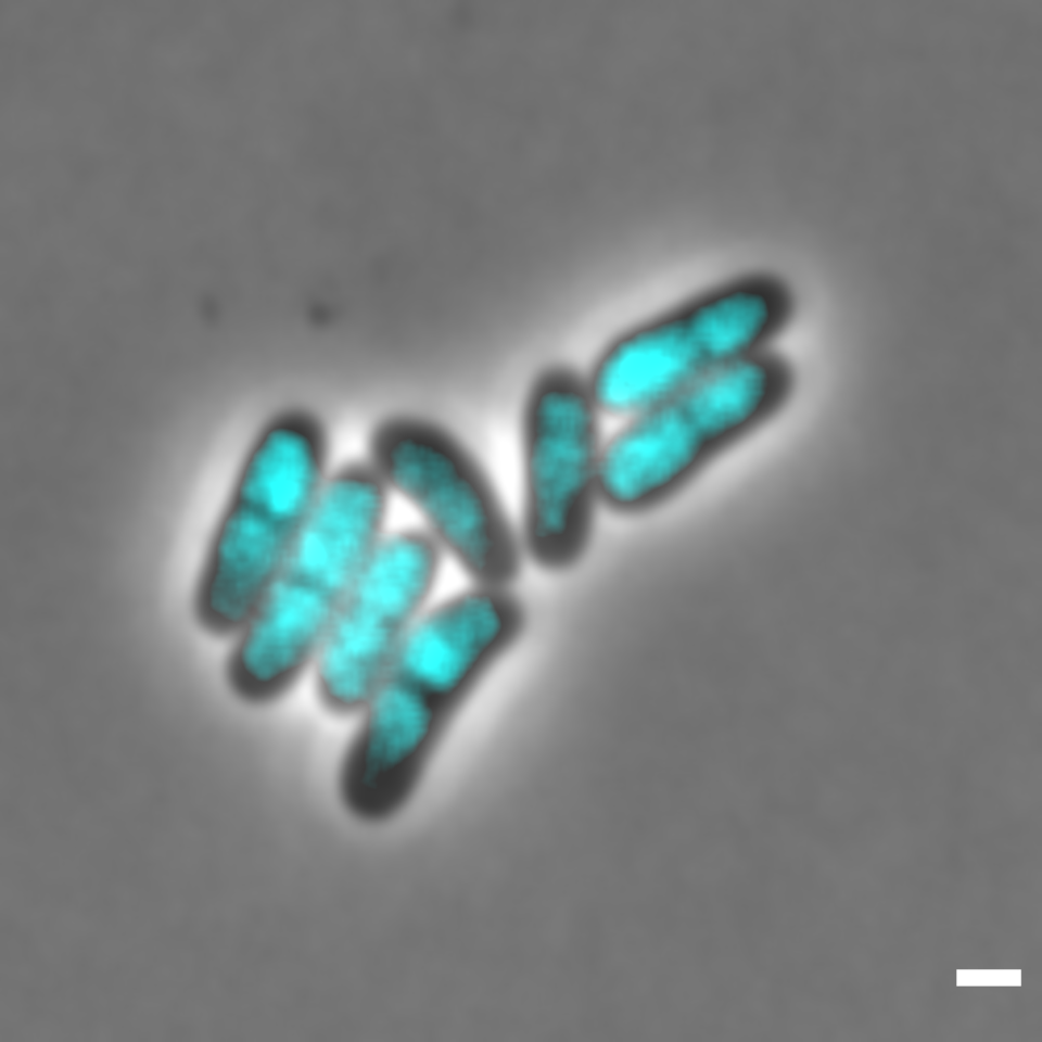 How to handle cellular DNA? Chromosomes and plasmids as substrates for condensins.