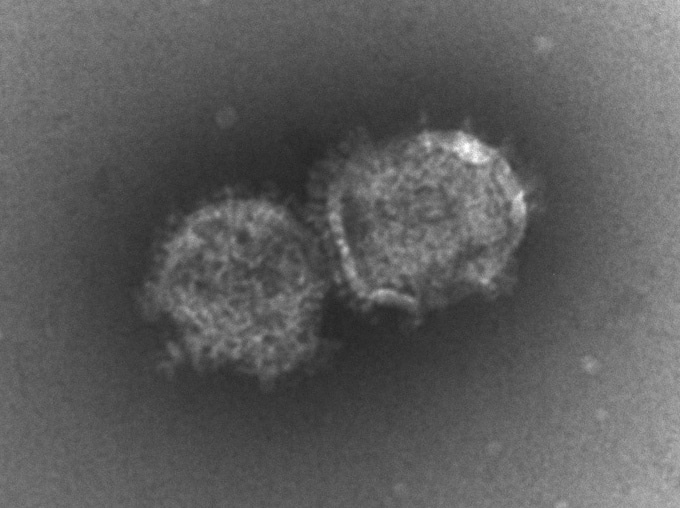 Packing viral suitcases with genomic scissors for therapeutic exon skipping