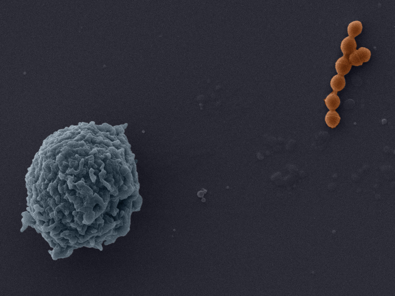 How to outwit Group B Streptococcus: Mimic its potent toxin in a vaccine
