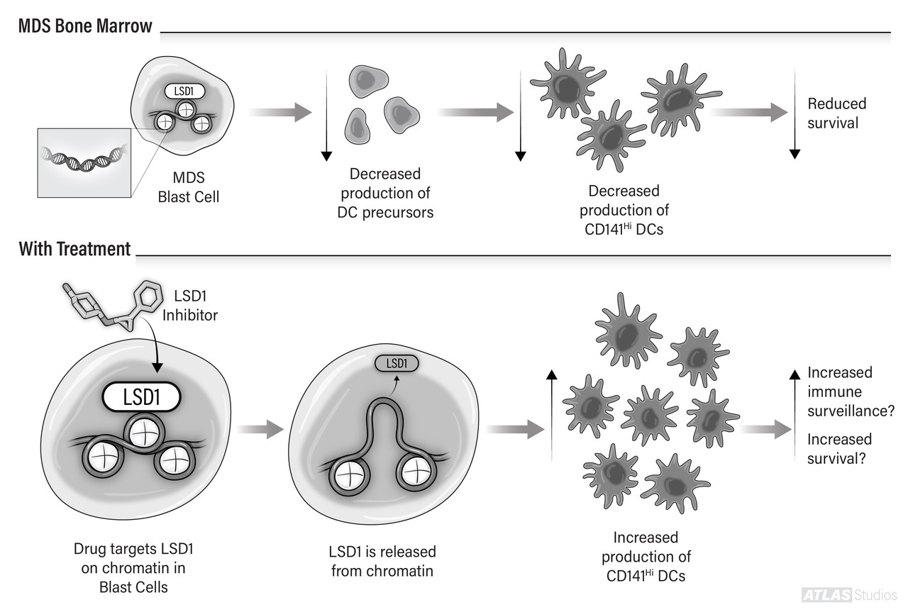 Epigenetic Therapy Promotes Dendritic Cell Differentiation in MDS