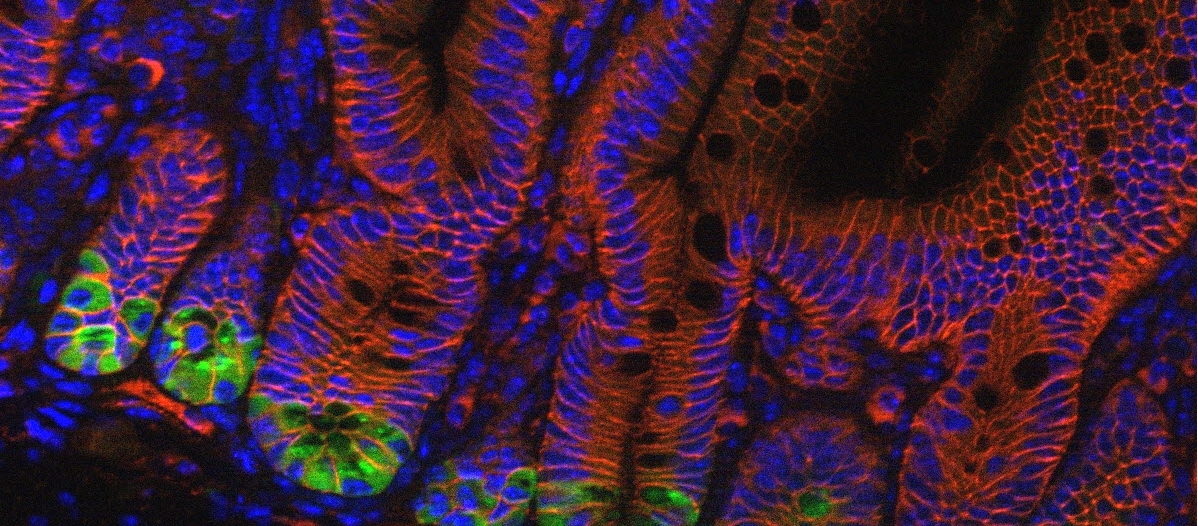 News from TCF7L2, β-Catenin’s (dispensable) partner in crime