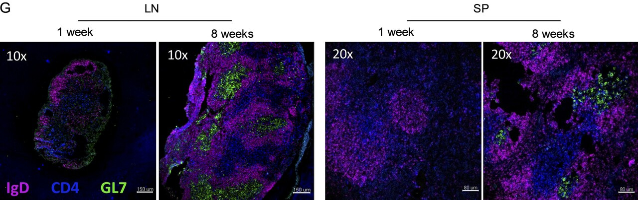 Signalling failure delays training of antibody in early life.