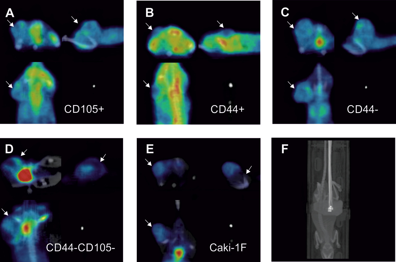Looking for cancer stem cells signature in renal cancer cells