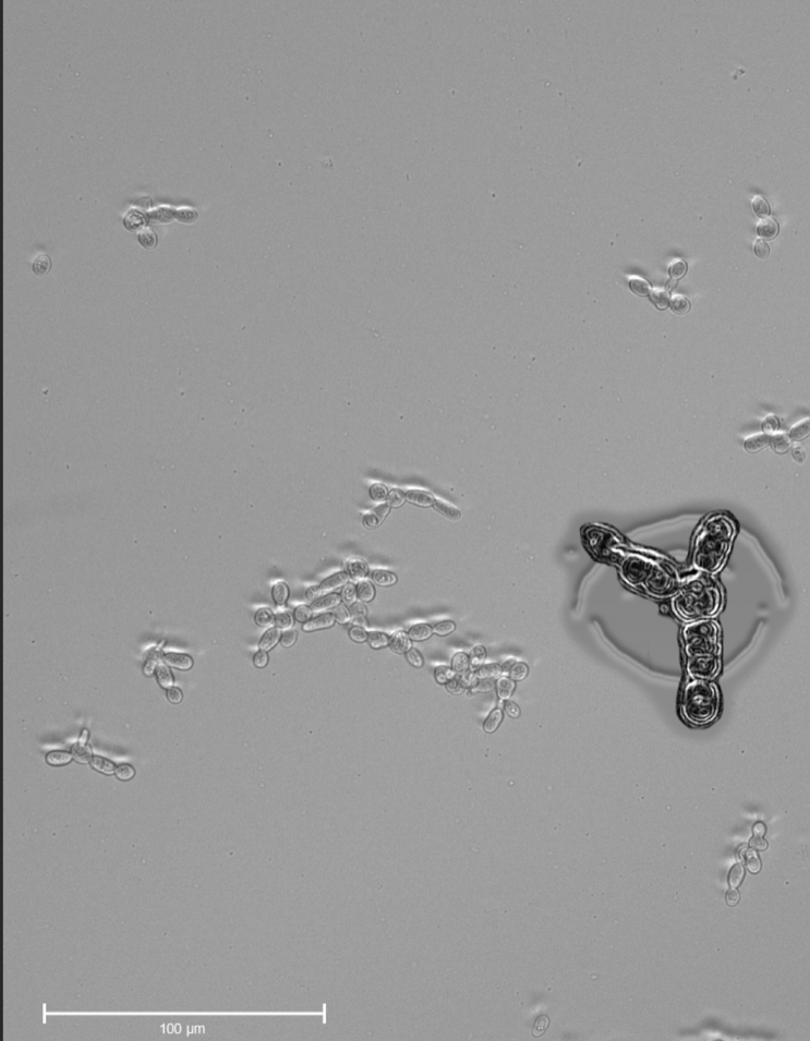 Frankenyeasts: synthetic yeast cells with genomic contributions from 6 species  