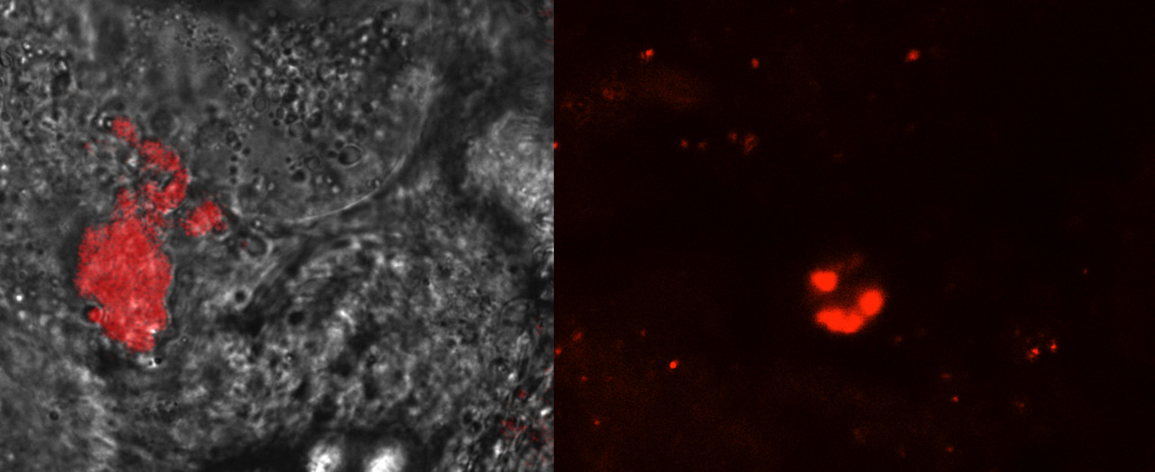 A step towards enlisting symbiotic microbes in the fight against malaria