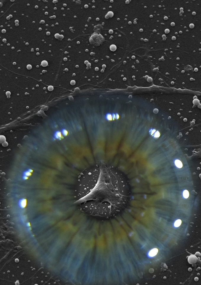 SUBRETINALLY INJECTED SEMICONDUCTING POLYMER NANOPARTICLES RESCUE VISION IN A RAT MODEL OF RETINAL DYSTROPHY