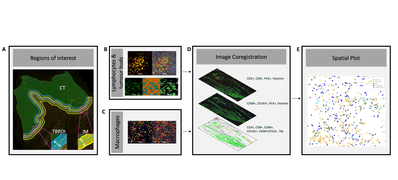 Using automated image analysis to identify CRC patients with low-risk in disease-specific death