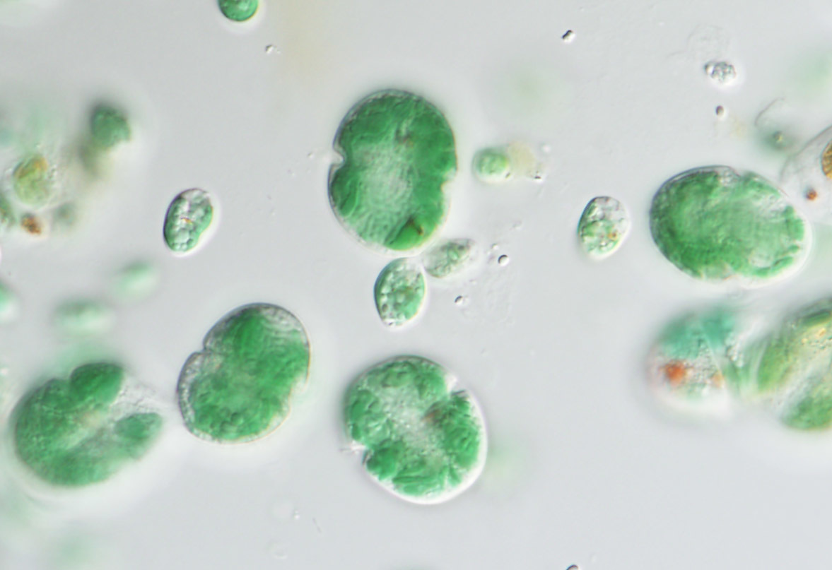 Thievery as a lesson to become photosynthetic eukaryotes? –a transient endosymbiosis in a kleptoplastic dinoflagellate