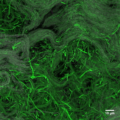 Cheaters never win:

Evolution of phenotypic heterogeneity in biofilms