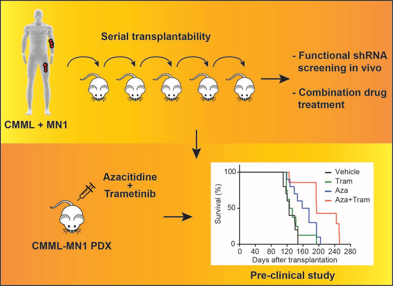 Effective drug treatment identified by in vivo screening in a transplantable patient-derived xenograft model of chronic myelomonocytic leukemia