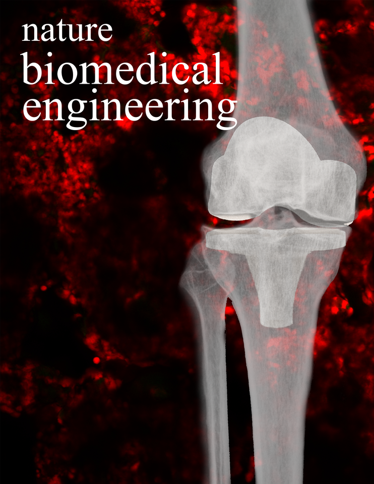Improving the treatment of prosthetic joint infection
