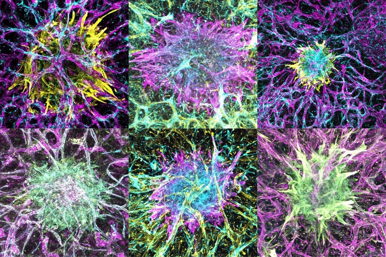 Multidisciplinary collaborative research to develop Organ-on-Chips in the UK