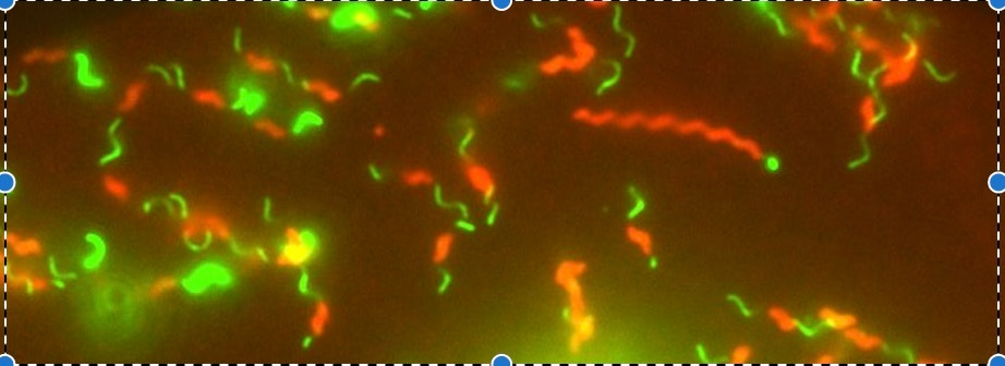 Secrets of Campylobacter jejuni's swimming style revealed by high-speed video 