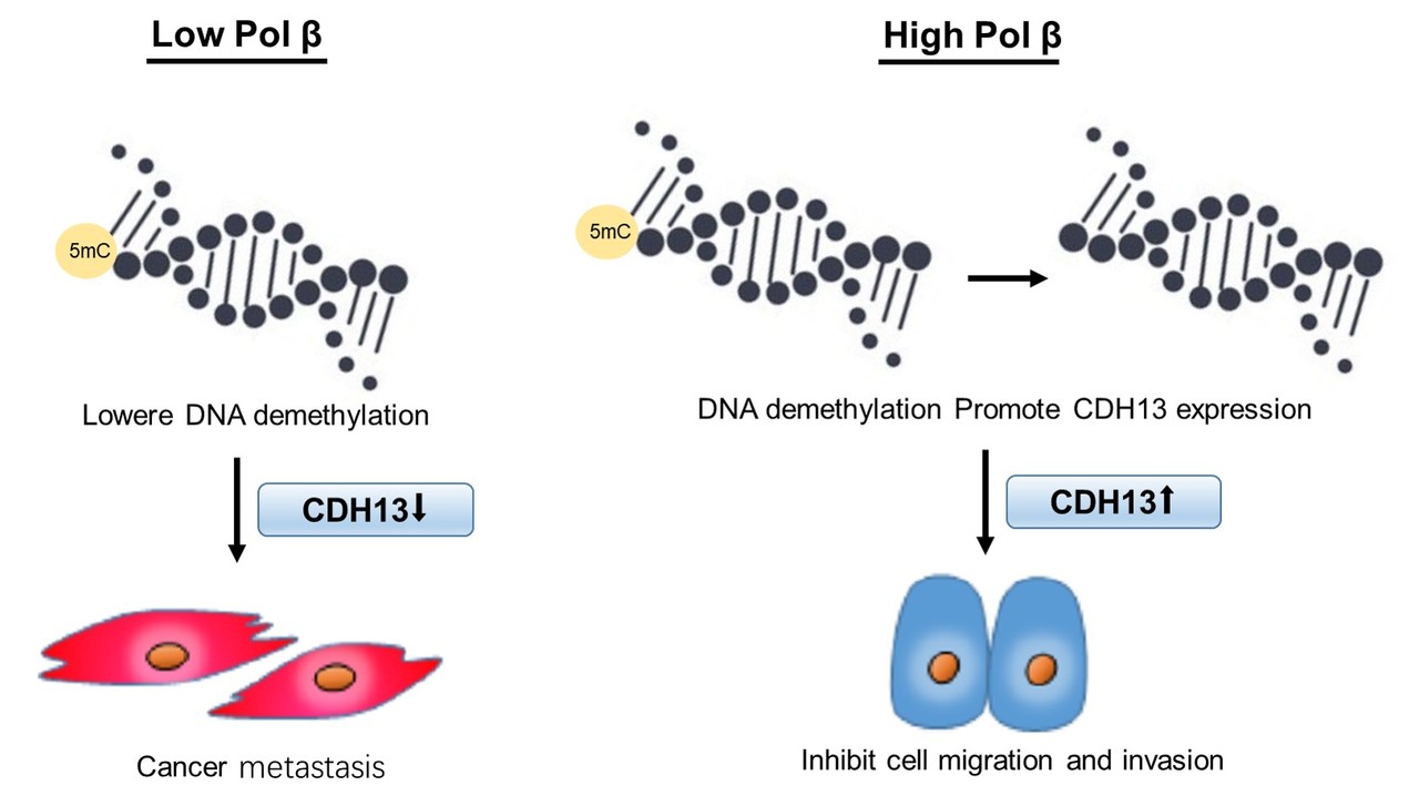DNA polymerase beta modulates cancer progression via gene expression regulation