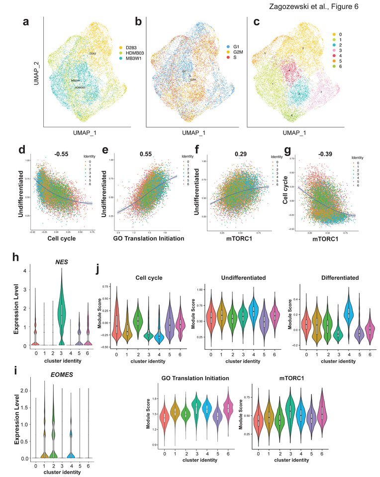 An OTX2-PAX3 signaling axis regulates Group 3 medulloblastoma cell fate