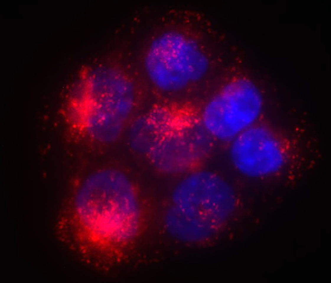 N-Myristoyltransferase-1 is necessary for Lysosomal Degradation and mTORC1 Activation in Cancer Cells