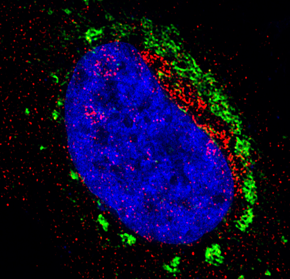 Zika Virus: Master Membrane Manipulator
