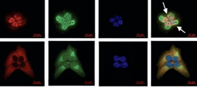 Serum deprivation initiates adaptation and survival to oxidative stress in prostate cancer cells