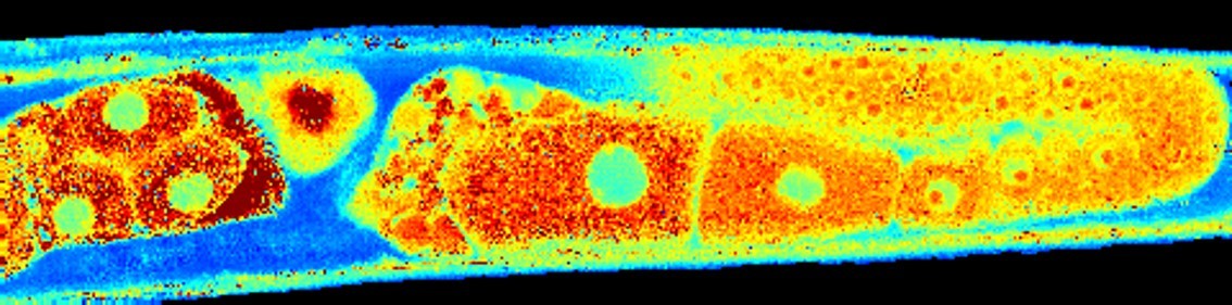 Three dimensional biomechanical imaging by stimulated Brillouin scattering microscopy