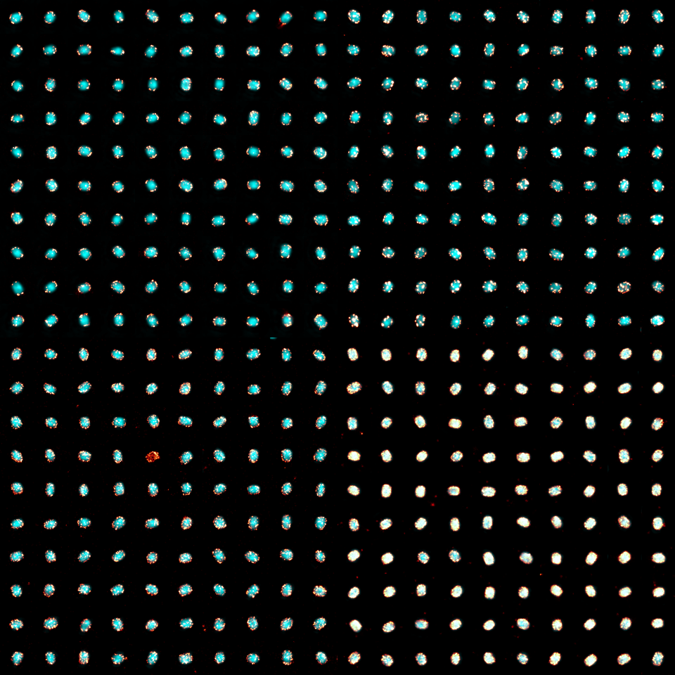 The tip(s) of the iceberg: Super-resolving poxvirus protein architecture